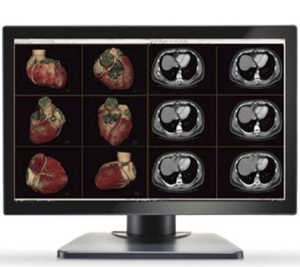 Diagnostic imaging monitors Gemini 6mp large-format double black medical diagnostic displays