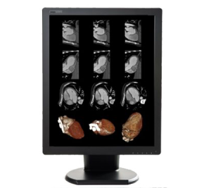 Diagnostic imaging monitors 3mp Color (C3MPN) double black medical diagnostic displays