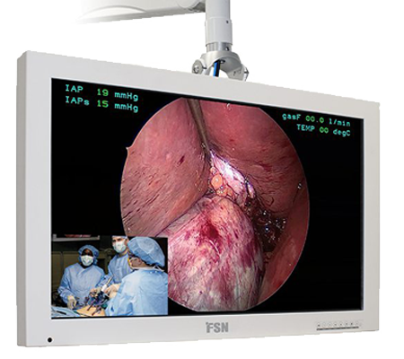32″ surgical displays medical grade and surgery monitor