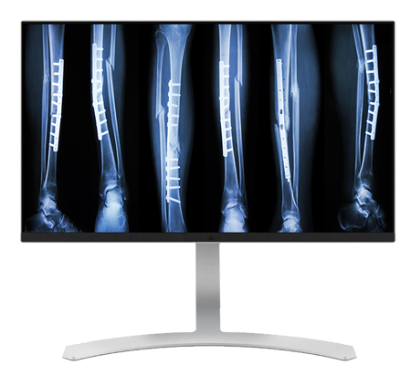 Radiology Monitors