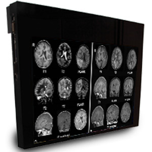 24” MR Safe Medical Display MRI Monitor Advanced Medical Imaging Technology