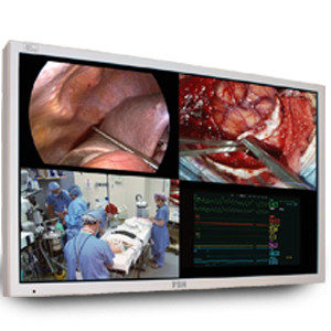Surgical Displays