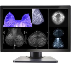 Diagnostic imaging monitors Gemini series 8mp large-format double black medical diagnostic displays