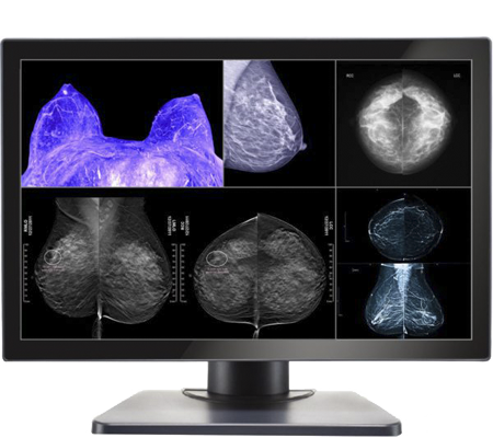 Diagnostic imaging monitors Gemini series 8mp large-format double black medical diagnostic displays