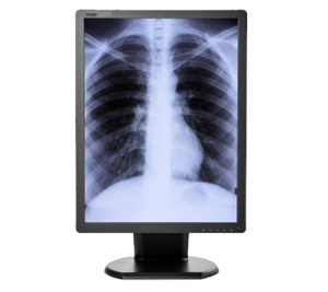 Diagnostic imaging monitors 3mp Grayscale (M3MPN) double black medical diagnostic displays