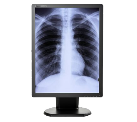 Diagnostic imaging monitors 3mp Grayscale (M3MPN) double black medical diagnostic displays