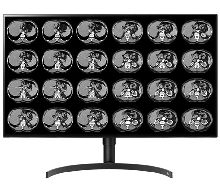 Diagnostic imaging monitors 32″ Color 8mp large-format double black medical diagnostic displays