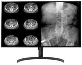 Diagnostic imaging monitors 32″ Color 8mp large-format double black medical diagnostic displays