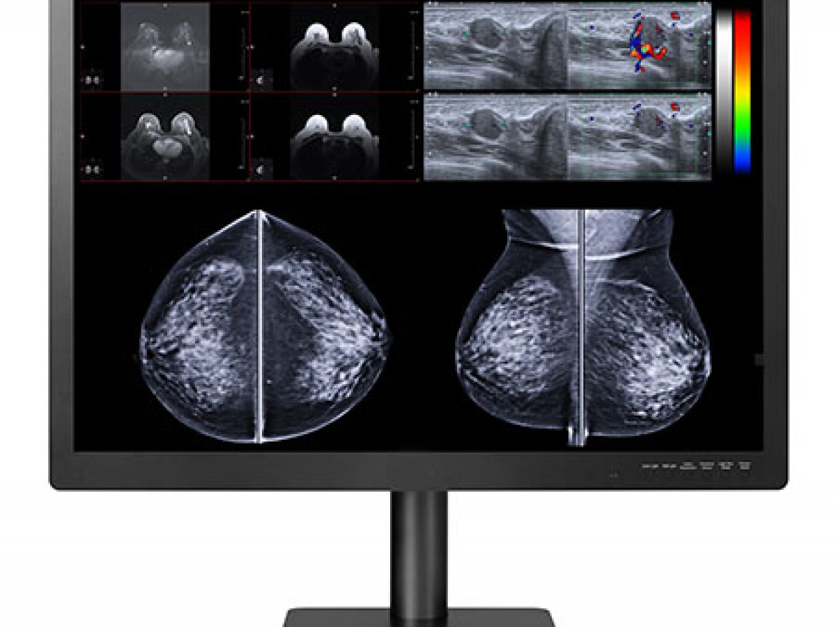 Image Systems Medical Diagnostic & Radiology Monitors