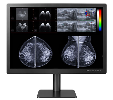 Diagnostic imaging monitors displays Gemini series 12mp large-format double black medical diagnostic displays