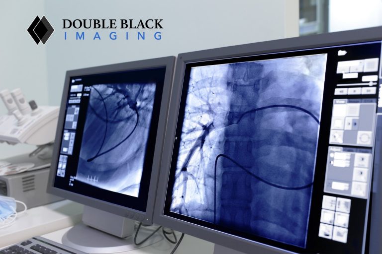 Benefits of Mobile Medical Imaging Mobile Medical Imaging Equipment