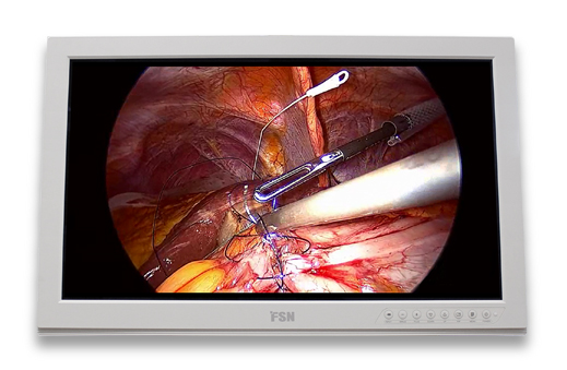 26″ surgical displays medical grade and surgery monitor