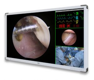 4K 55″ surgical displays medical grade and surgery monitor