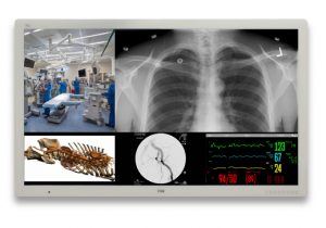 4K 58″ surgical displays medical grade and surgery monitor
