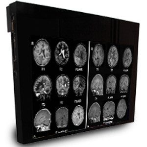 32” MR Safe Medical Display MRI Monitor Advanced Medical Imaging Technology