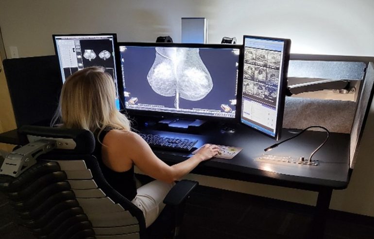 DBI breast imaging 12MP display, flanked by dual 3MP diagnostic displays, mounted on the Phoenix II ergonomic workstation