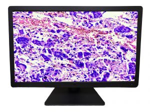 Digital Pathology Displays