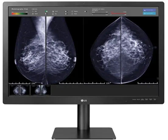 12MP Color Radiology Breast Imaging Display