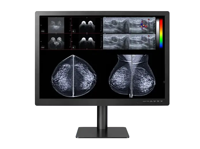 12MP Display for Breast imaging
