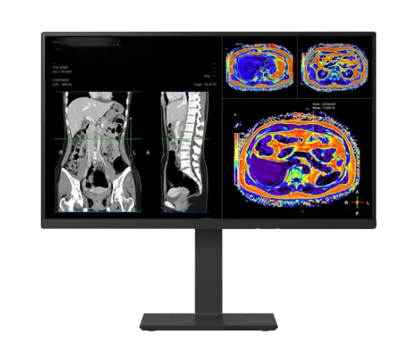 27 inch 8MP Clinical Review Display
