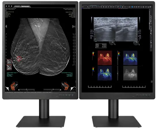 5MP DH Color Radiology Breast Imaging Display