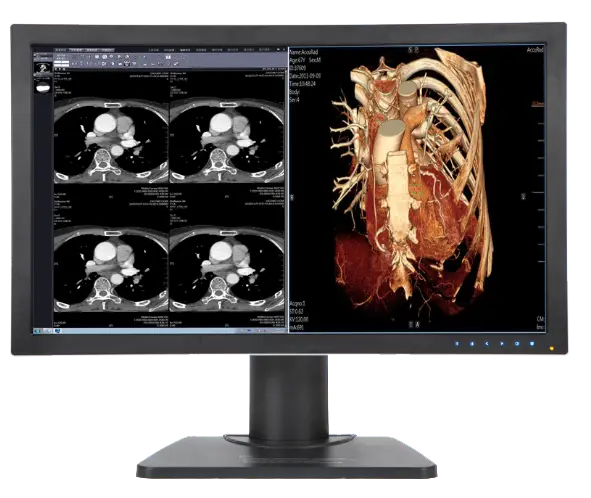 6MPG+ 6MP Color Radiology Display