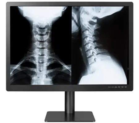 Gemini 8MP+ Radiology Display