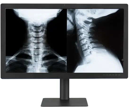 8MP+ 8MP Color Radiology Display