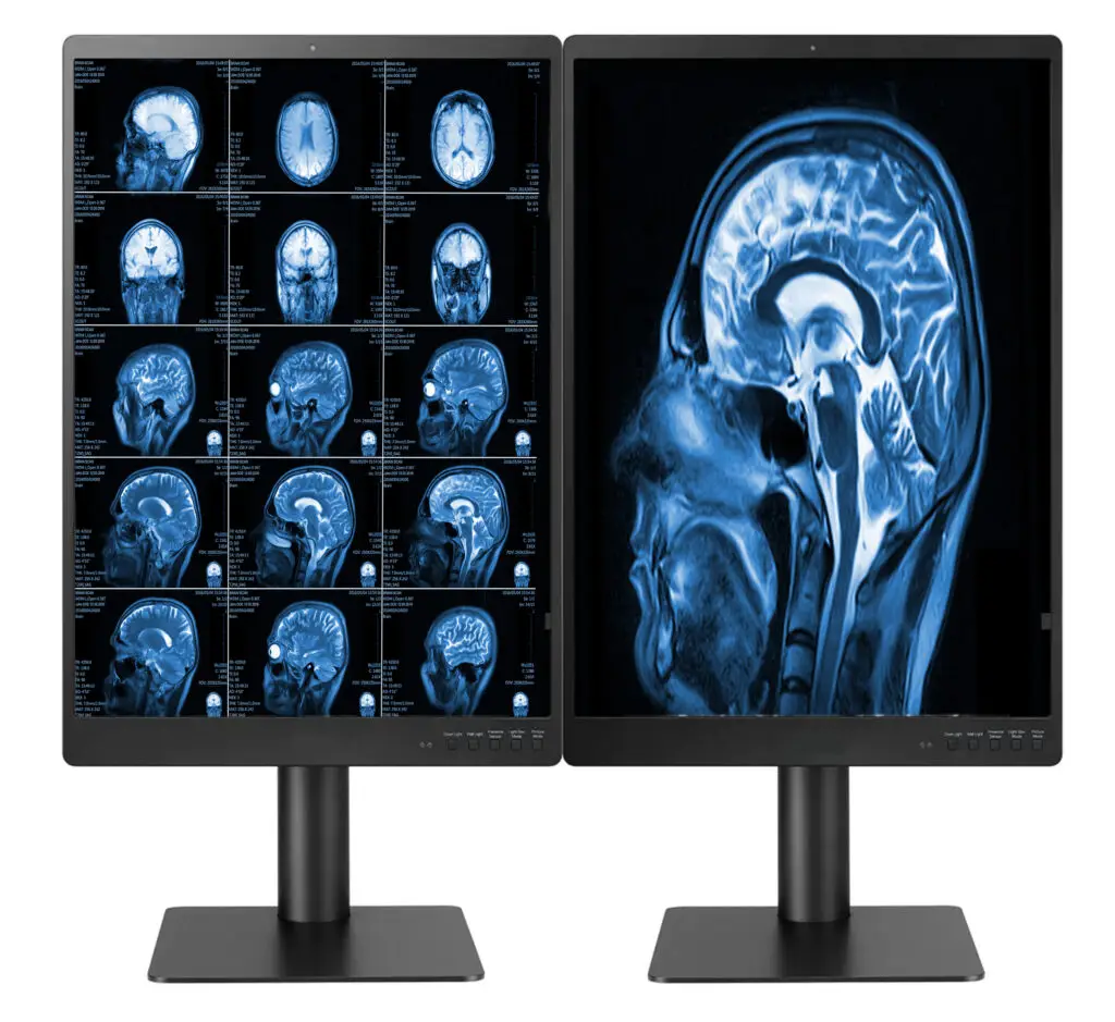 3MP Dual Head Display for Radiology