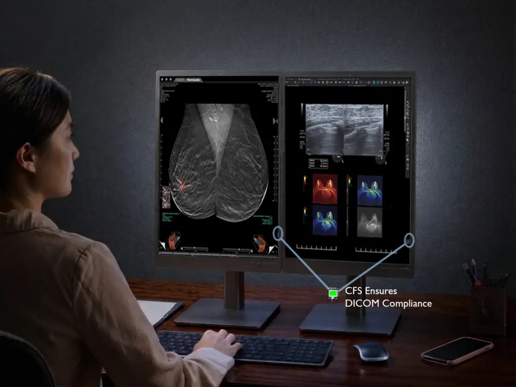 CFS Monitoring on 5MP Dual Head