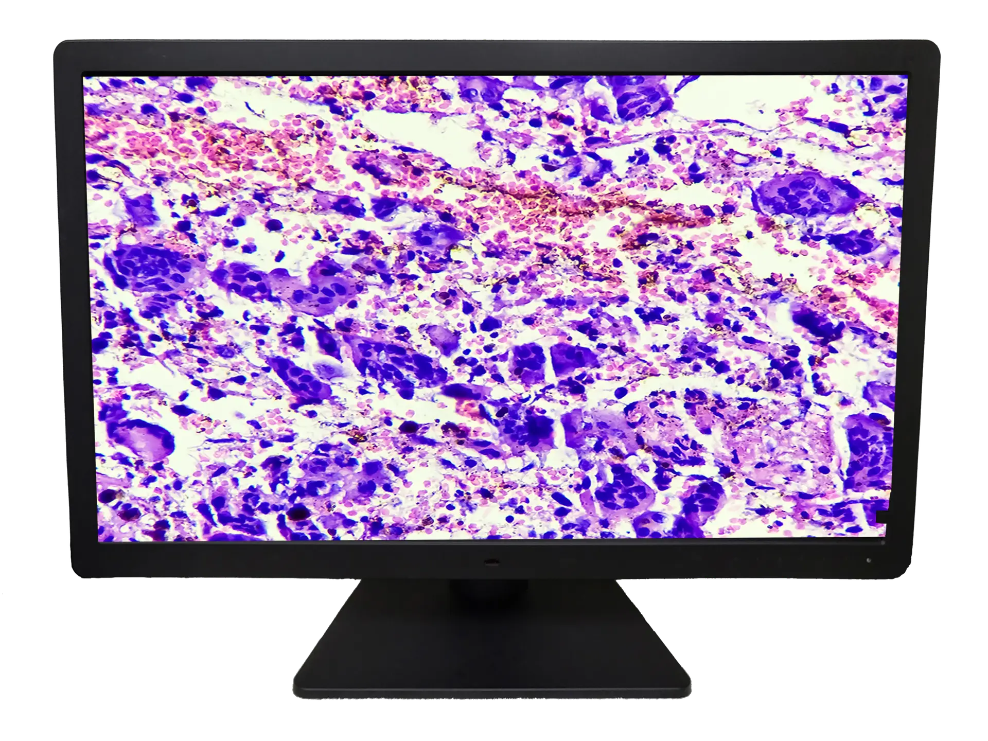 27" 8MP Display for Digital Pathology