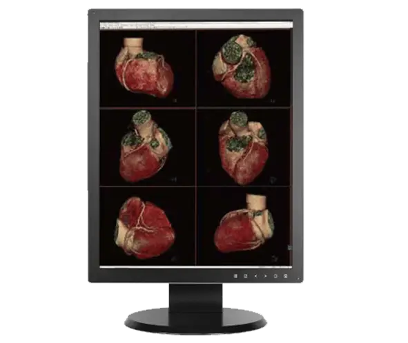 2MP+ Clinical Display
