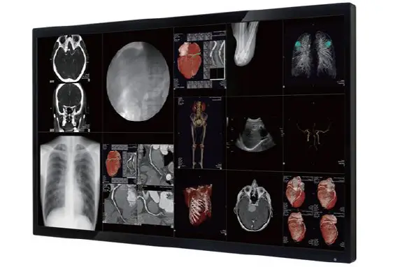 43 inch PACS in the OR Display