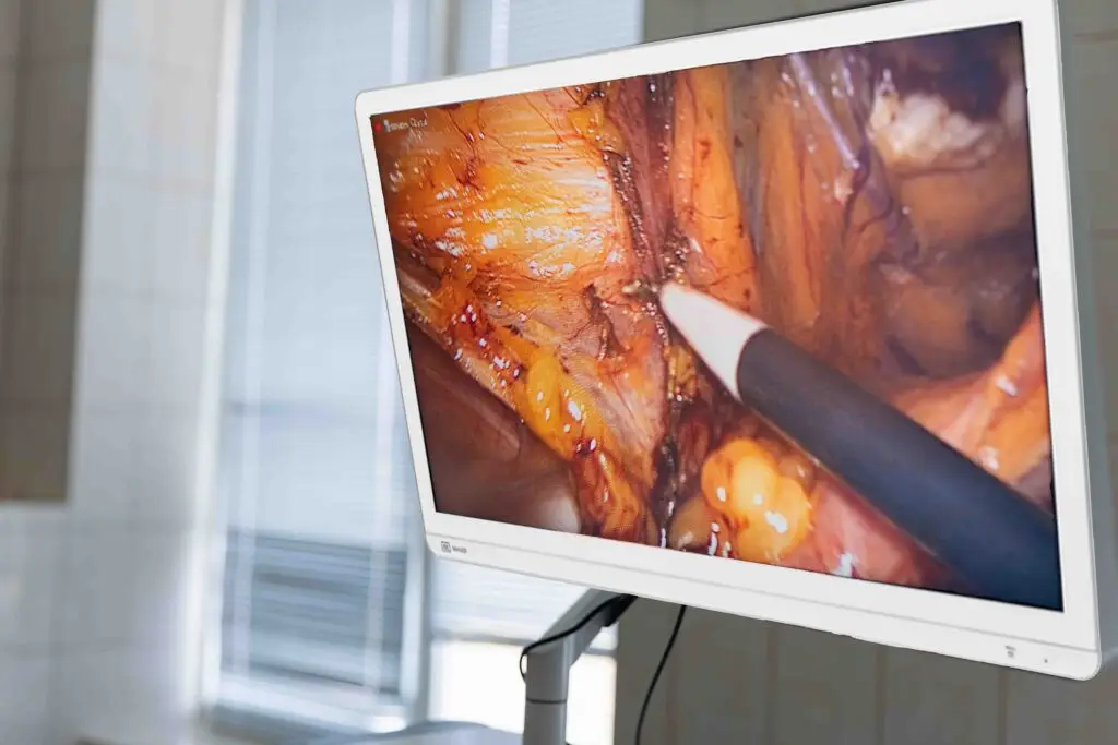 DB32SF-4K in Laparoscopic procedure