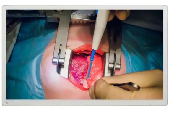 DB55SF Surgical Display