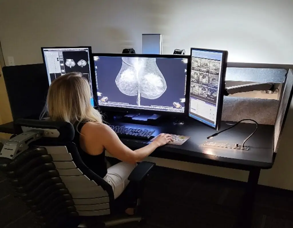 DBI breast imaging 12MP display, flanked by dual 3MP diagnostic displays, mounted on the Phoenix II ergonomic workstation
