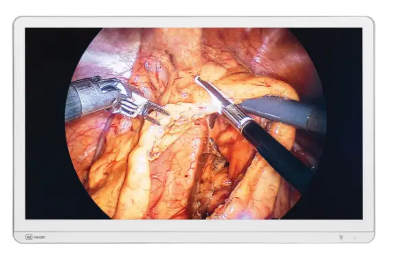 DB32SF 4k Surgical Display