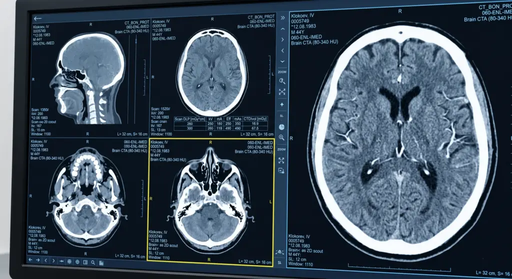 Side View of Diagnostic Monitor with Head CT