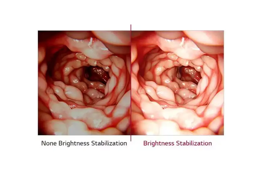 Brightness Stabilization