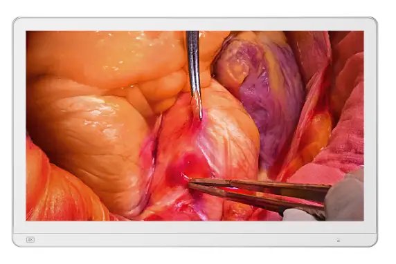 DB27SF-4K Surgical Display