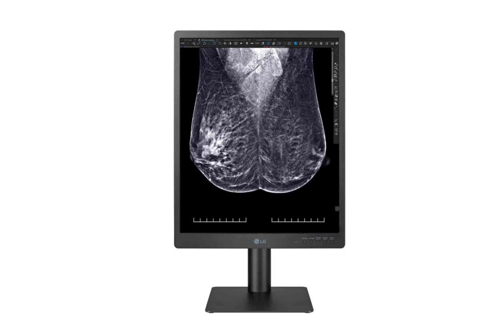5MP Color display for digital breast imaging 21HQ613D
