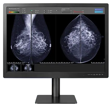 12MP For Breast Imaging